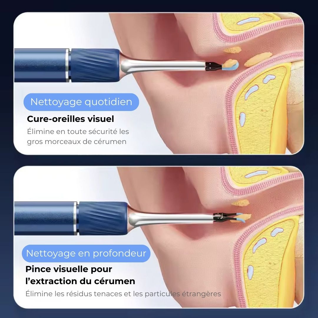 Nettoyeur d’oreilles intelligent avec caméra HD (Android/iOS)